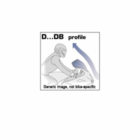 Givi D301DB Windscreen - CBR600 RR (03-04) 